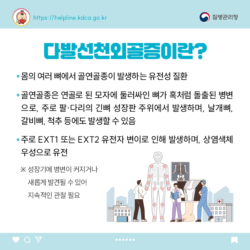 다발선천외골증이란? - 몸의 여러 뼈에서 골연골종이 발생하는 유전성 질환 - 골연골종은 연골로 된 모자에 둘러싸인 뼈가 혹처럼 돌출된 병변으로, 주로 팔·다리의 긴뼈 성장판 주위에서 발생하며, 날개뼈, 갈비뼈, 척추 등에도 발생할 수 있음 - 주로 EXT1 또는 EXT2 유전자 변이로 인해 발생하며, 상염색체 우성으로 유전 ※ 성장기에 병변이 커지거나 새롭게 발견될 수 있어 지속적인 관찰 필요